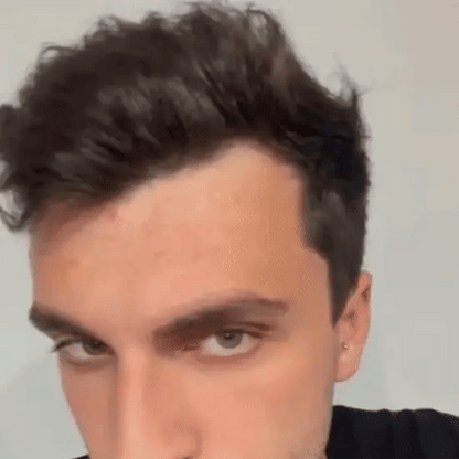 Esencia Germinal de Jengibre - Crecimiento Capilar en 7 Días | SensuFit