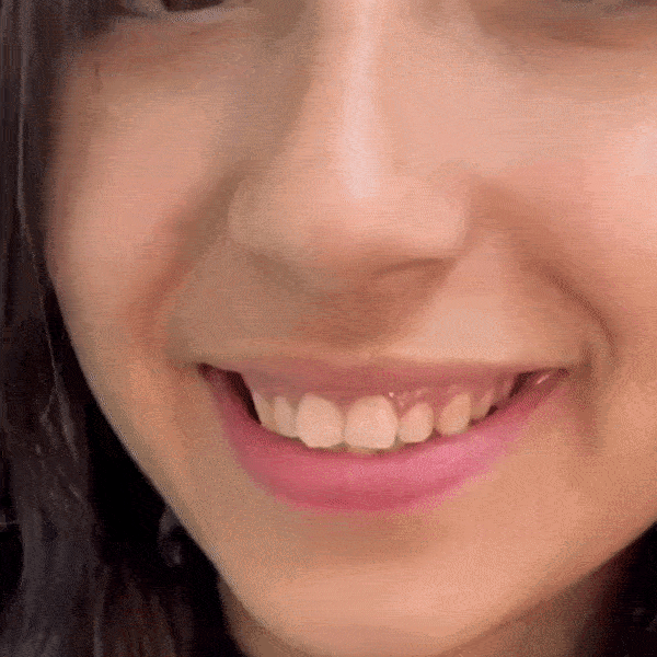 Carillas Dentales Adaptables - Transforma tu Sonrisa 😱OFERTA EXCLUSIVA 2X1😱